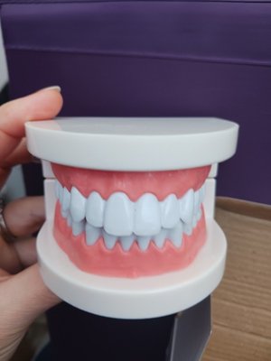 Photo of free Model of teeth (Dean Court OX2)
