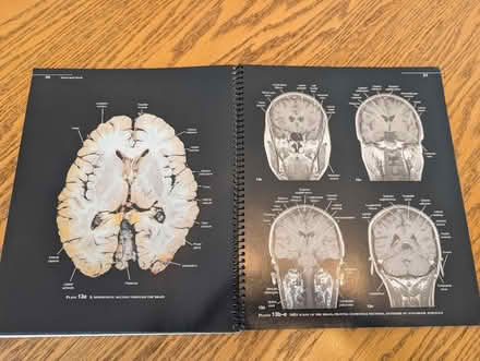 Photo of free Anatomical atlas (Rawdon LS19) #2