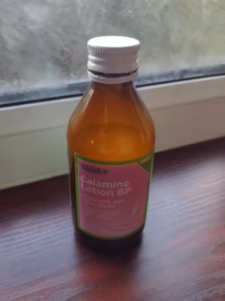 Photo of free Calamine Lotion (Shaw Side OL2) #1