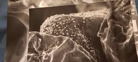 Photo of free plant cell electron micrographs (melrose) #1