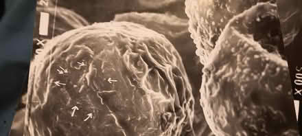 Photo of free plant cell electron micrographs (melrose) #4