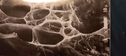 Photo of free plant cell electron micrographs (melrose) #2