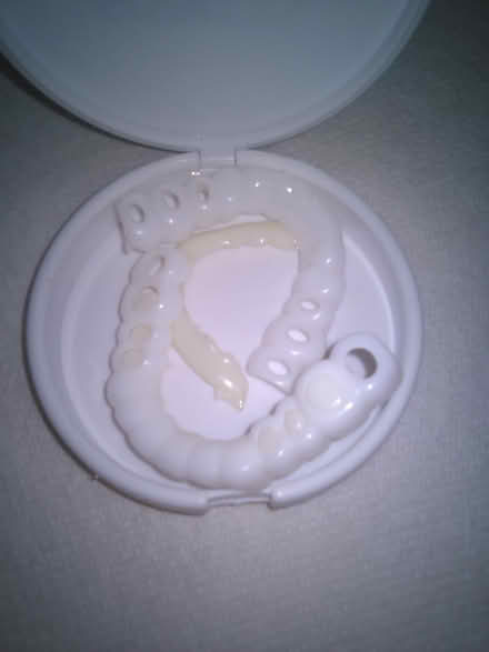 Photo of free Smile Veneers (60th cedar ave 19143) #4