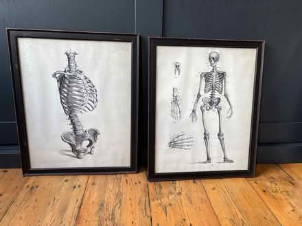 Photo of free 2 Framed skeleton pictures (SE11 Kennington) #1