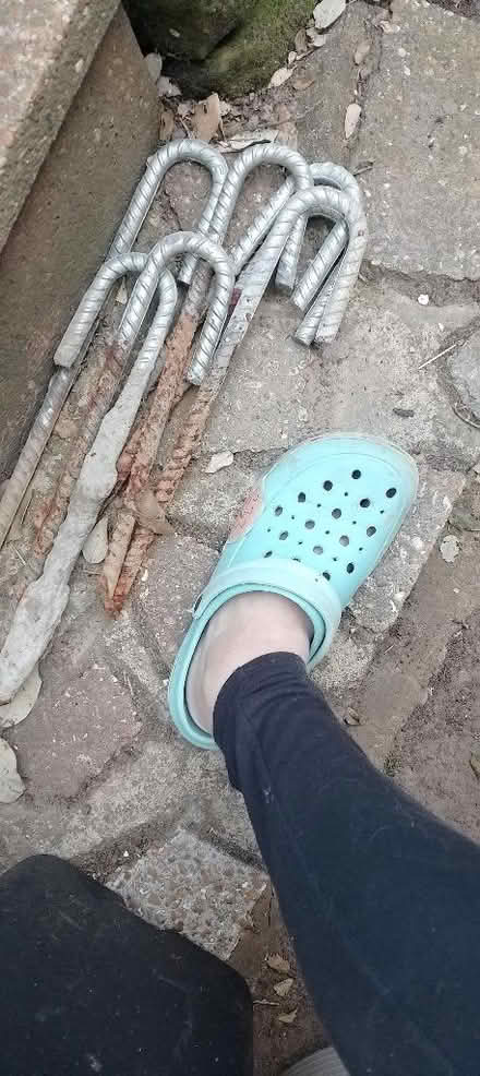 Photo of free Heavy duty pegs (St Leonards TN38) #1