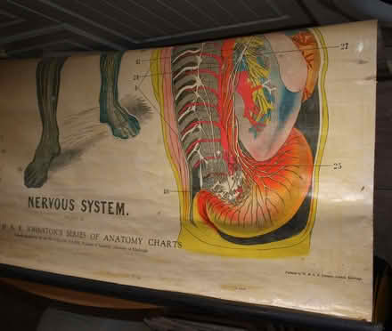 Photo of free Anatomical wallchart (Gorebridge EH23) #1