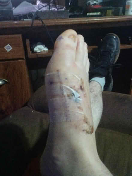 Photo of Disabled for 8 more weeks (Oakland city Indiana) #1