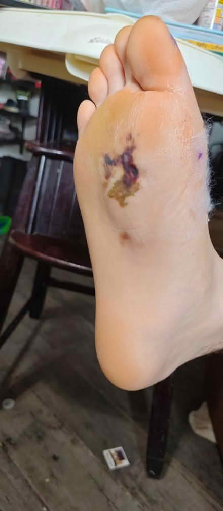 Photo of Disabled for 8 more weeks (Oakland city Indiana) #2
